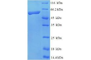 SDS-PAGE (SDS) image for Kinesin Family Member 1A (KIF1A) (AA 1-361), (Kinesin-motor domain), (partial) protein (His-SUMO Tag) (ABIN5709803) (KIF1A Protein (AA 1-361, Kinesin-motor domain, partial) (His-SUMO Tag))