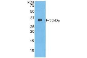 Detection of Recombinant ABCA3, Human using Polyclonal Antibody to ATP Binding Cassette Transporter A3 (ABCA3) (ABCA3 antibody  (AA 1358-1635))