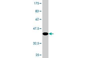 Western Blot detection against Immunogen (43. (TAF12 antibody  (AA 1-161))