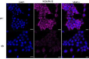 anti-NADH Dehydrogenase (Ubiquinone) 1 alpha Subcomplex, 13 (NDUFA13) antibody