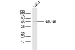 U251 lysates probed with NSUN5 Polyclonal Antibody, Unconjugated  at 1:300 dilution and 4˚C overnight incubation. (NSUN5 antibody  (AA 2-100))