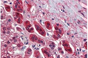 Human Adrenal (formalin-fixed, paraffin-embedded) stained with TCF21 antibody ABIN462190 followed by biotinylated goat anti-rabbit IgG secondary antibody ABIN481713, alkaline phosphatase-streptavidin and chromogen. (TCF21 antibody  (AA 42-91))