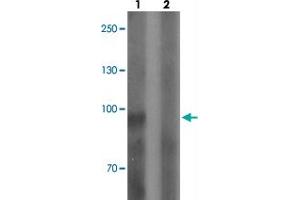 Western blot analysis of SGSM3 in 293 cell lysate with SGSM3 polyclonal antibody  at 1 ug/mL in (1) the absence and (2) the presence of blocking peptide. (SGSM3 antibody  (N-Term))
