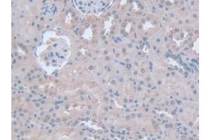 Detection of IFNg in Rat Kidney Tissue using Polyclonal Antibody to Interferon Gamma (IFNg) (Interferon gamma antibody  (AA 23-156))