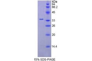 SDS-PAGE (SDS) image for Hexokinase 2 (HK2) ELISA Kit (ABIN6574314)