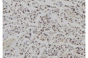 ABIN6266065 and ABIN6278212 at 1/100 staining Human lung tissue by IHC-P.