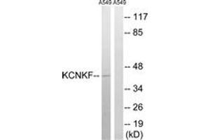 Western blot analysis of extracts from A549 cells, using KCNK15 Antibody. (KCNK15 antibody  (AA 273-322))