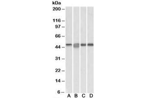 Western blot testing of Daudi [A], Jurkat [B], K562 [C] and MOLT4 [D] lysates with MAP2K2 antibody at 0. (MEK2 antibody)