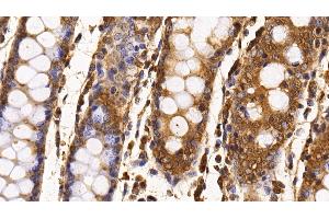 Detection of Surv in Porcine Colon Tissue using Monoclonal Antibody to Survivin (Surv) (Survivin antibody  (AA 1-142))