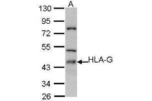 WB Image Sample (30 ug of whole cell lysate) A: Molt-4 , 10% SDS PAGE antibody diluted at 1:500 (HLAG antibody)
