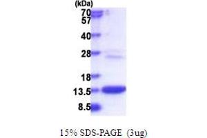 SDS-PAGE (SDS) image for COMM Domain Containing 6 (COMMD6) (AA 1-85) protein (His tag) (ABIN5853820) (COMMD6 Protein (AA 1-85) (His tag))