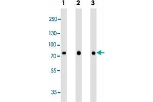 Western blot analysis of Lane 1: A549 cell line lysates Lane 2: A431 cell line lysates Lane 3: SK-BR-3 cell line lysates reacted with CAPN2 monoclonal antibody  at 1:1000 dilution. (Calpain 2 antibody)