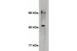 Western blot on human kidney lysate (10 ug/lane) using  anti Serine palmitoyltransferase 1 antibody (cat X2066P) at 1 ug/ml. (SPTLC1 antibody)