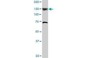 ITPKB MaxPab rabbit polyclonal antibody. (ITPKB antibody  (AA 1-644))