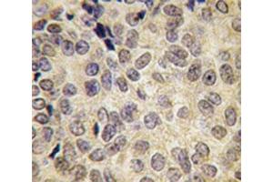 Immunohistochemistry (IHC) image for anti-DNA (Cytosine-5-)-Methyltransferase 3 beta (DNMT3B) (AA 389-417) antibody (ABIN3030752)