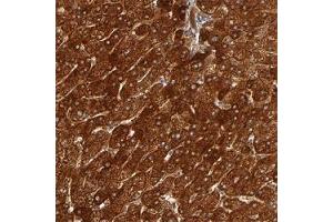 Immunohistochemical staining (Formalin-fixed paraffin-embedded sections) of human liver shows strong cytoplasmic positivity in hepatocytes. (ISG15 antibody)