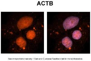 Sample Type: NT2 cells Red: Antibody Blue: DAPI Primary Dilution: 1ug/50ul antibody Secondary Antibody: Alexa goat anti-rabbit 594 Image Submitted by: Yuzhi Chen, University of Arkansas for Medical Sciences (beta Actin antibody  (Middle Region))