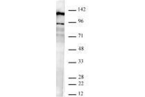 JMJD2B / KDM4B antibody (rAb) tested by Western blot.