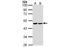 WB Image Sample (30 ug of whole cell lysate) A: 293T B: A431 , 10% SDS PAGE antibody diluted at 1:5000 (FH antibody)