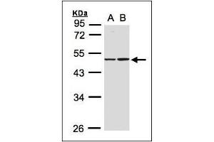 Sample(30 ug whole cell lysate). (Isocitrate Dehydrogenase antibody)