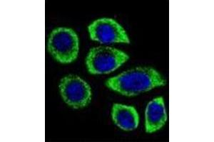 Confocal immunofluorescent analysis of PIP5KL1 Antibody (N-term) Cat. (PIP5KL1 antibody  (N-Term))