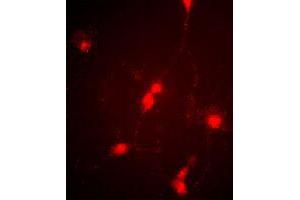 Immunofluorescence image of cultured chick retinal amacrine (neuronal) cells labeled with CLCN4 polyclonal antibody .