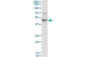 ENO1 polyclonal antibody (A01), Lot # SFU4050831QCS1. (ENO1 antibody  (AA 1-434))
