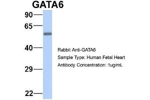 Host:  Rabbit  Target Name:  GATA6  Sample Type:  Human Fetal Heart  Antibody Dilution:  1. (GATA6 antibody  (N-Term))