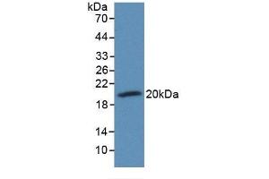 Detection of Recombinant CD59, Rabbit using Monoclonal Antibody to Cluster of Differentiation 59 (CD59) (CD59 antibody  (AA 25-104))
