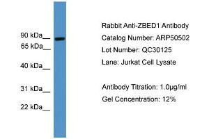 WB Suggested Anti-ZBED1  Antibody Titration: 0. (ZBED1 antibody  (C-Term))