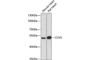 Western blot analysis of extracts of various cell lines, using CLN5 antibody (ABIN6133293, ABIN6138735, ABIN6138736 and ABIN6216682) at 1:3000 dilution. (CLN5 antibody  (AA 96-407))