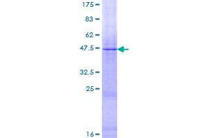 Factor VIII Protein (AA 1-216) (GST tag)