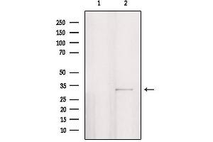 Western blot analysis of extracts from HepG2, using PPP1R3D Antibody. (PPP1R3D antibody  (Internal Region))