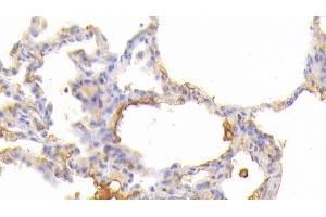 Detection of JAK3 in Human Lung Tissue using Polyclonal Antibody to Janus Kinase 3 (JAK3) (JAK3 antibody  (AA 716-967))