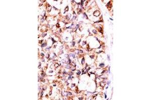 Image no. 2 for anti-Protein Phosphatase 5, Catalytic Subunit (PPP5C) (C-Term) antibody (ABIN360837)