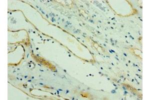 Immunohistochemistry of paraffin-embedded human kidney tissue using ABIN7164273 at dilution of 1:100 (PARL antibody  (AA 1-170))