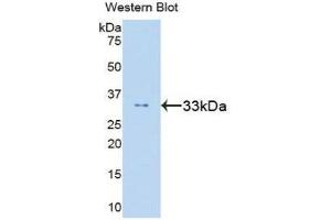 Western Blotting (WB) image for anti-Signal Transducer and Activator of Transcription 6, Interleukin-4 Induced (STAT6) (AA 262-520) antibody (ABIN1860655) (STAT6 antibody  (AA 262-520))