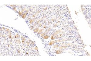 Detection of DGKz in Mouse Stomach Tissue using Polyclonal Antibody to Diacylglycerol Kinase Zeta (DGKz) (DGKZ antibody  (AA 657-879))