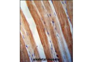 KBTBD5 antibody immunohistochemistry analysis in formalin fixed and paraffin embedded human skeletal muscle followed by peroxidase conjugation of the secondary antibody and DAB staining. (KBTBD5 antibody  (AA 349-377))