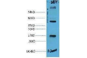 Western Blotting (WB) image for anti-EF-Hand Domain Family, Member D1 (EFHD1) antibody (ABIN3181263) (EFHD1 antibody)