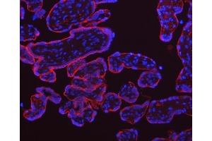 IF analysis of TFRC using anti-TFRC antibody (ABIN3043538).