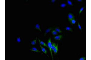 Immunofluorescent analysis of Hela cells using ABIN7149094 at dilution of 1:100 and Alexa Fluor 488-congugated AffiniPure Goat Anti-Rabbit IgG(H+L) (CYBB antibody  (AA 283-570))