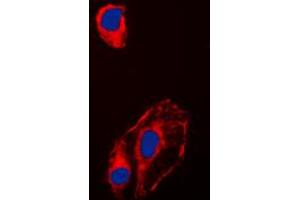 Immunofluorescent analysis of HSP90 beta (pS254) staining in HeLa cells. (HSP90AB1 antibody  (pSer254))