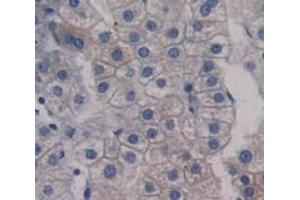 #VALUE! (SLC22A4 antibody  (AA 42-141))