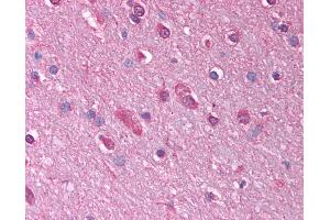 Anti-GABRQ antibody IHC of human brain, cortex. (GABRQ antibody  (AA 31-80))
