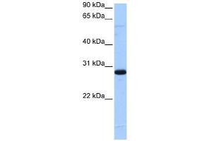 C1orf83 antibody used at 5 ug/ml to detect target protein. (TCEANC2 antibody  (N-Term))
