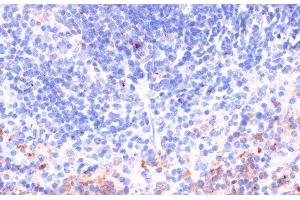 Immunohistochemistry (Paraffin-embedded Sections) (IHC (p)) image for anti-Perforin 1 (Pore Forming Protein) (PRF1) antibody (ABIN7254750)