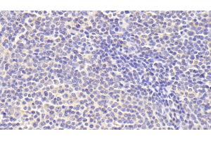 Detection of zAP70 in Human Lymph node Tissue using Polyclonal Antibody to Zeta Chain Associated Protein Kinase 70 kDa (zAP70) (ZAP70 antibody  (AA 337-600))