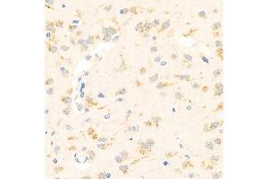 Immunohistochemistry (Paraffin-embedded Sections) (IHC (p)) image for anti-Actin Related Protein 2/3 Complex, Subunit 1B, 41kDa (ARPC1B) antibody (ABIN7072895)