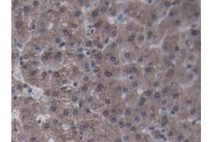 DAB staining on IHC-P; Samples: Porcine Liver Tissue (CRP antibody  (AA 20-222))